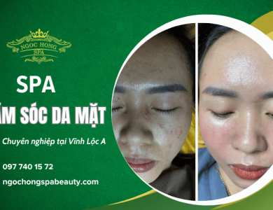 Spa chăm sóc da mặt Vĩnh Lộc A uy tín, chuyên nghiệp - Ngọc Hồng Spa