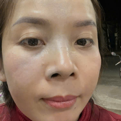 62