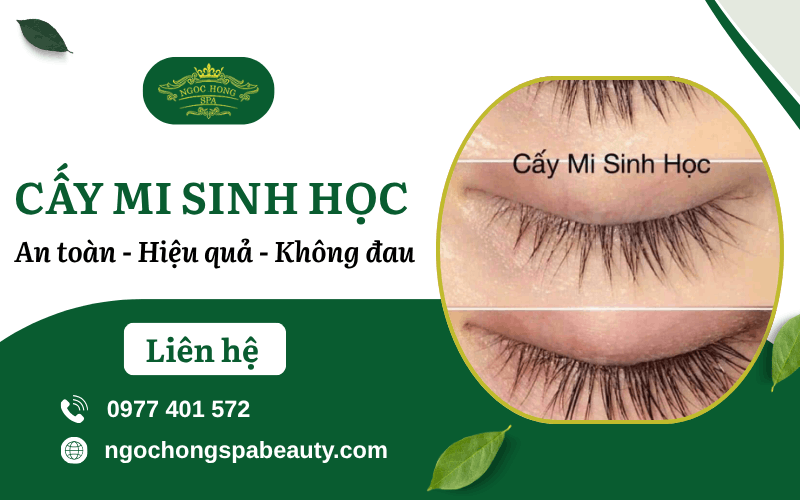 cấy mi sinh học