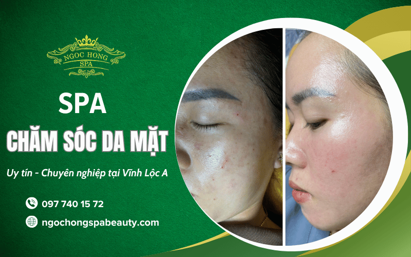 chăm sóc da mặt Vĩnh Lộc A
