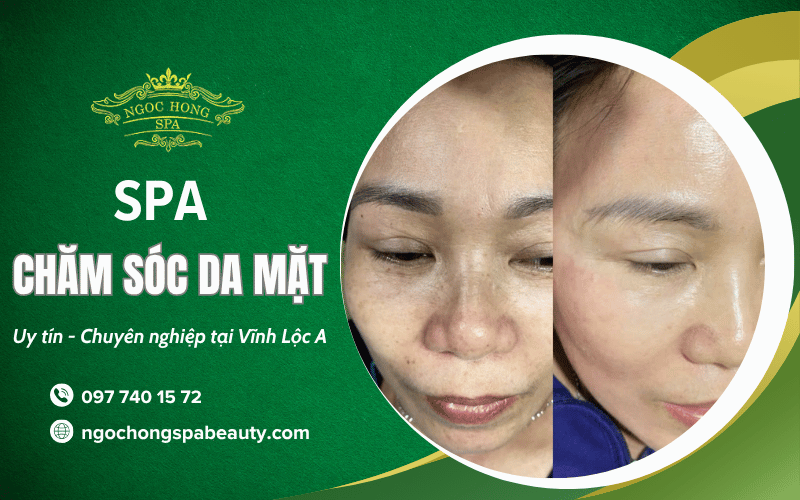 chăm sóc da mặt Vĩnh Lộc A