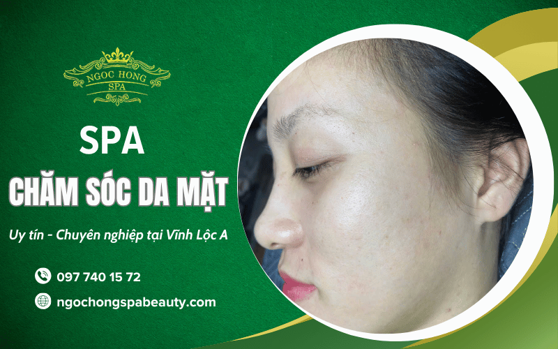 chăm sóc da mặt Vĩnh Lộc A