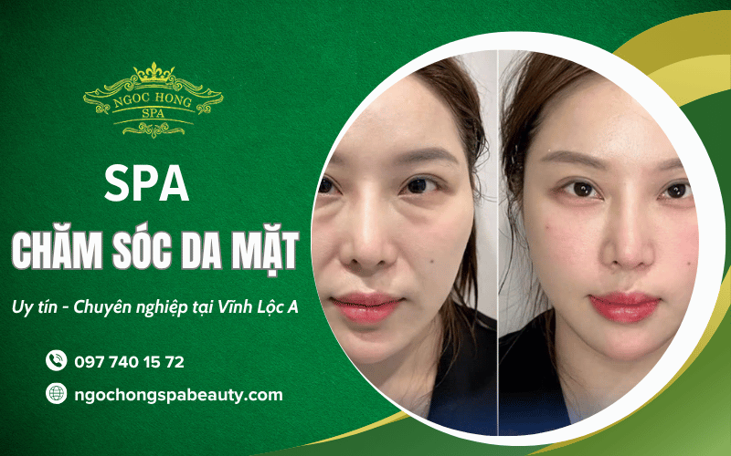 chăm sóc da mặt Vĩnh Lộc A