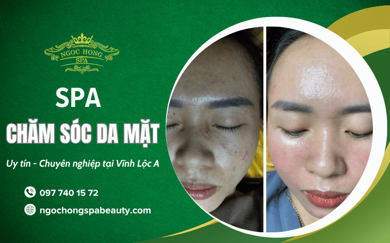 chăm sóc da mặt Vĩnh Lộc A